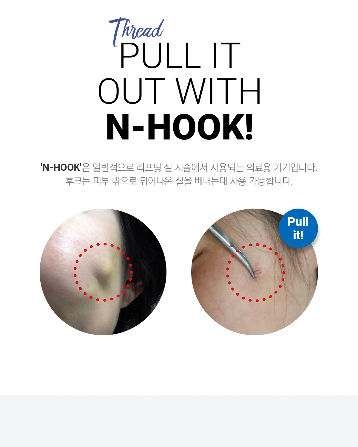 N-Hook-엔훅_02